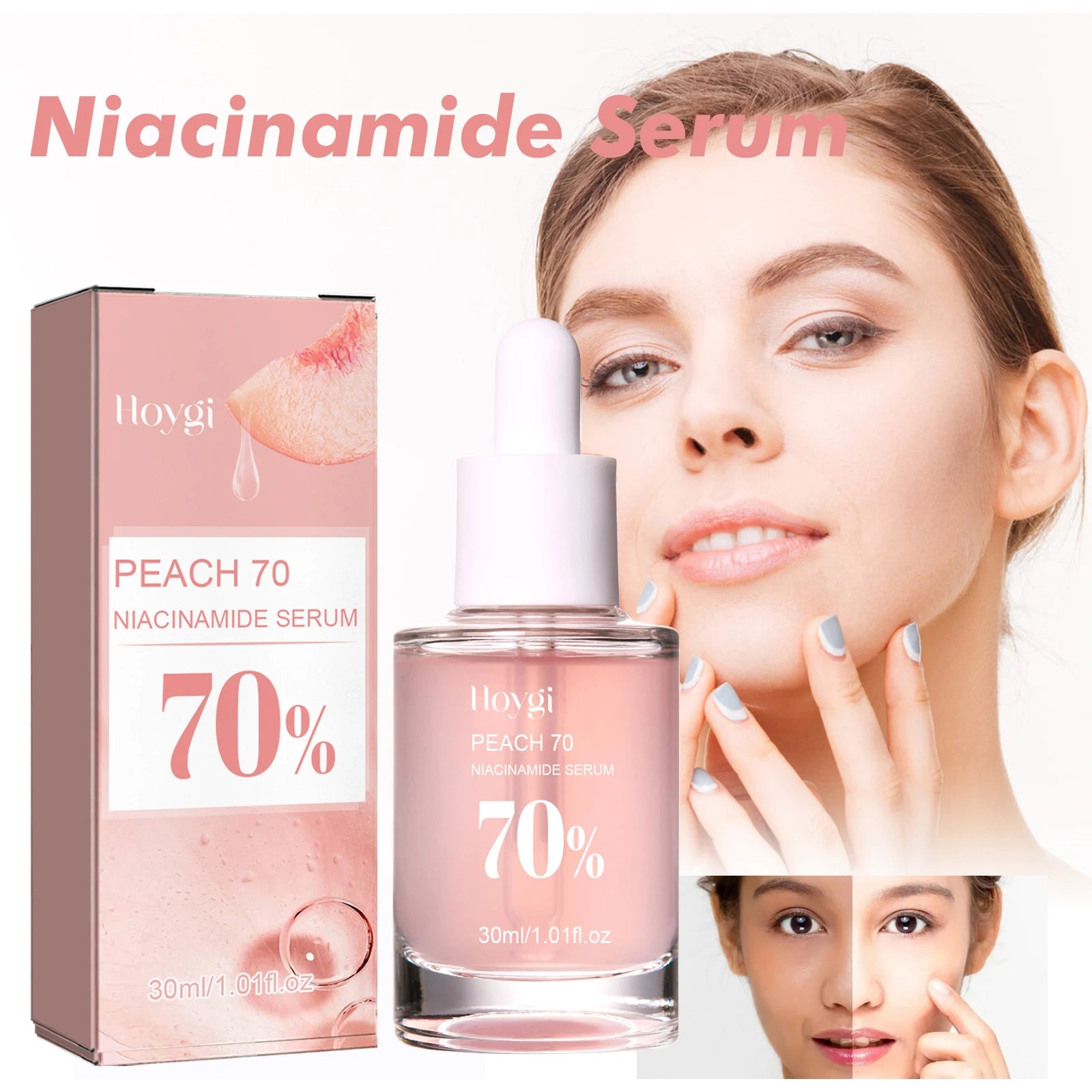 Niacinamide Serum Face Serum Pore Minimizing Brightening Blemish Dark Spot Treatment Oil Control Serum For Even Tone Skin 30ml