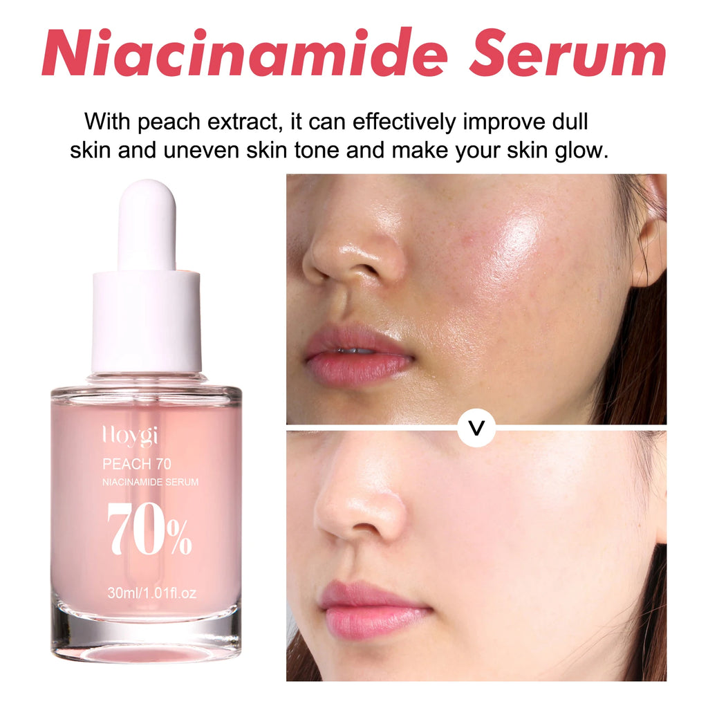 Niacinamide Serum Face Serum Pore Minimizing Brightening Blemish Dark Spot Treatment Oil Control Serum For Even Tone Skin 30ml