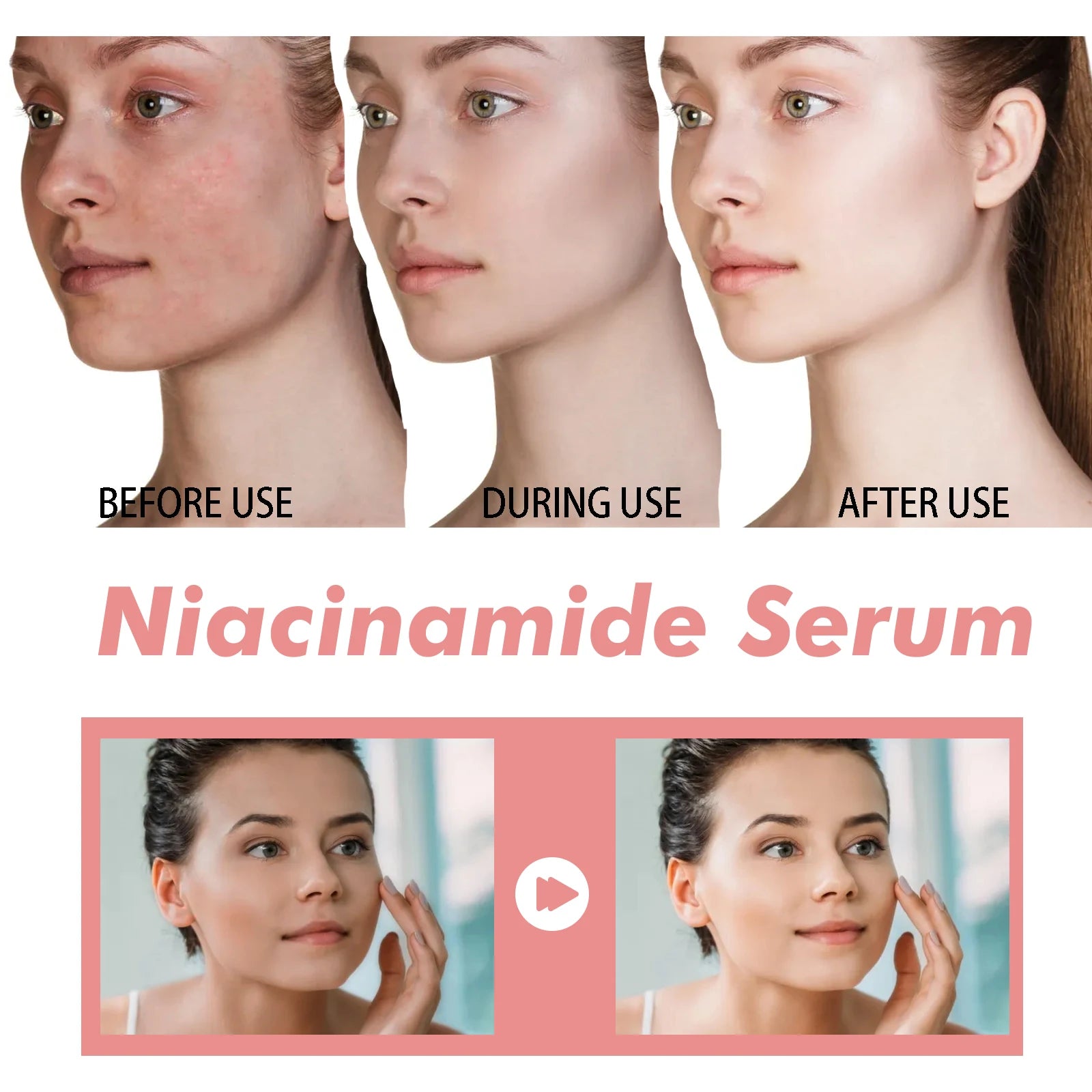 Niacinamide Serum Face Serum Pore Minimizing Brightening Blemish Dark Spot Treatment Oil Control Serum For Even Tone Skin 30ml